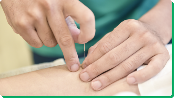 鍼治療の施術を受ける様子